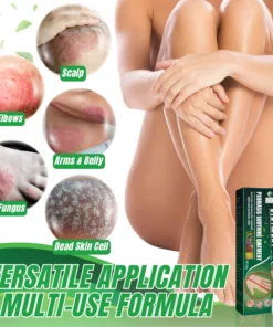 PUREX™ PSORIASIS SOOTHING OINTMENT