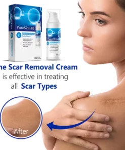 PureSkin™ Vitamin B12 Scar Repair Cream