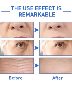 Reveal™ Botox Face Serum