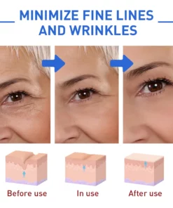 Reveal™ Botox Face Serum