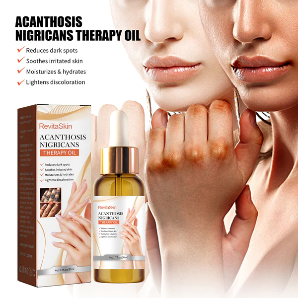 RevitaSkin™ Acanthosis Nigricans Therapy Oil