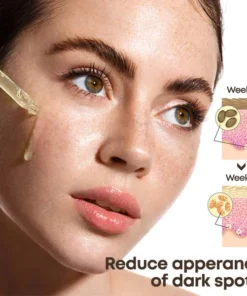 RevitaSkin™ Acanthosis Nigricans Therapy Oil