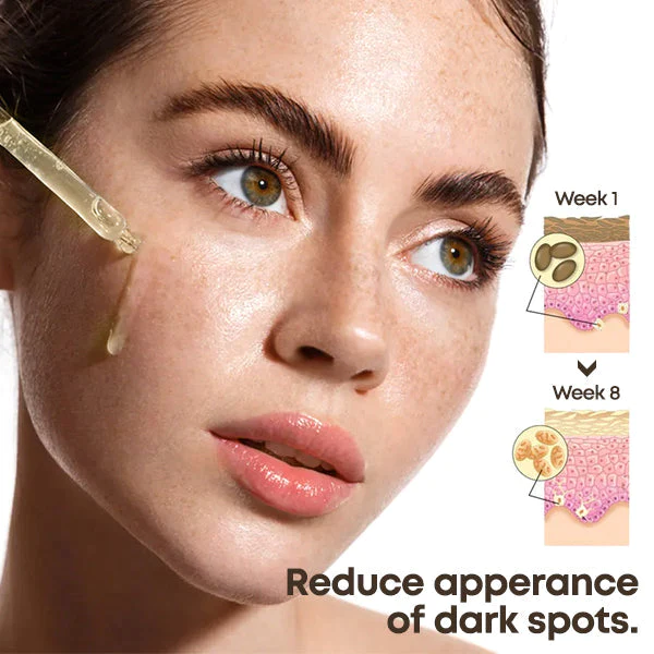 RevitaSkin™ Acanthosis Nigricans Therapy Oil