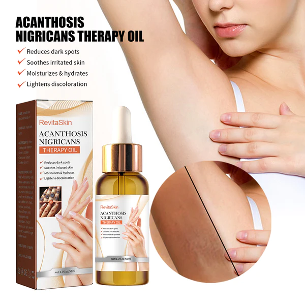 RevitaSkin™ Acanthosis Nigricans Therapy Oil