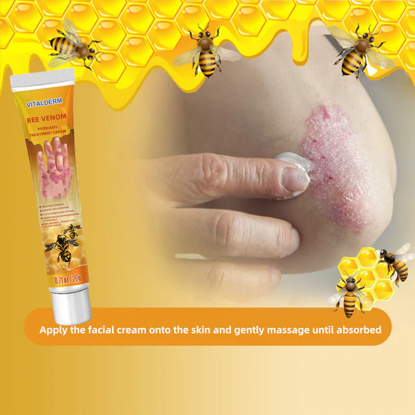 Крем за третман на псоријаза со отров од пчели VitalDerm™