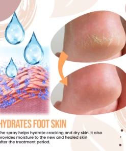 Zakdavi™️Foot Callus Removal Spray