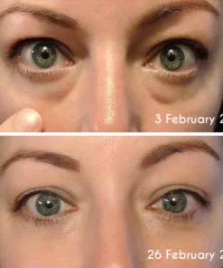 flysmus™ DEleventh Pro-Xylane Active Eye Cream