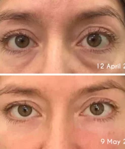 flysmus™ DEleventh Pro-Xylane Active Eye Cream