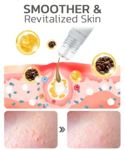 flysmus™ Milkia Spot Removal Lifting Eye Gel