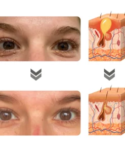 flysmus™ Milkia Spot Removal Lifting Eye Gel