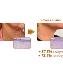 flysmus™ RevitaPeptide Reversal Serum