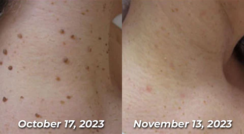 flysmus™ TagRecede Bee Venom Bioactive Compounds Spray
