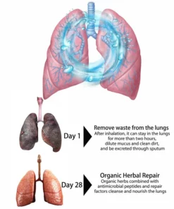 ANWX South Moon™ Organic Herbal Lung Cleanse & Repair Nasal Spray PRO