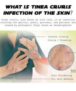 Alternative view of ATTDX AthletesFoot FungusRelief TreatmentSpray