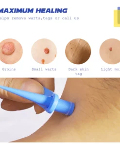 Alternative view of ATTDX AutoRemove SkinTag Kit