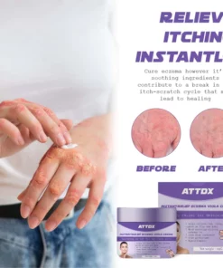 Alternative view of ATTDX InstantRelief Eczema ViolaCream