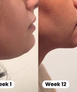 Aurora™ Lymphatic Auricular Therapy Germanium Earrings