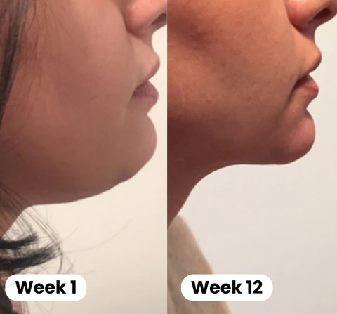 Aurora™ Lymphatic Auricular Therapy Germanium Earrings