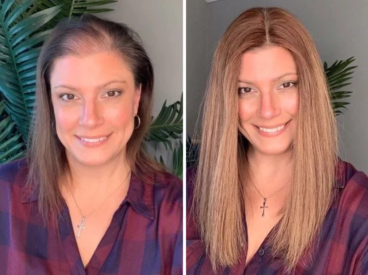 Biancat™ Hair DensityBoost Capsules