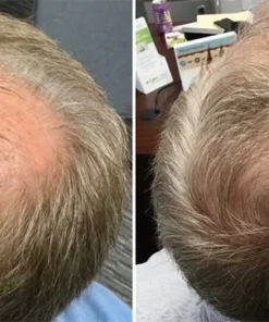 Biancat™ Hair DensityBoost Capsules