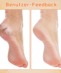 Alternative view of Biancat™ Hornhaut-Entfernendes Fußspray