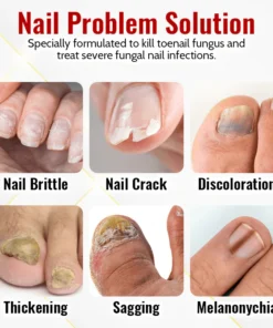 Biancat™ Japanese NailRenew Onychomycosis Rapid Relief Oil