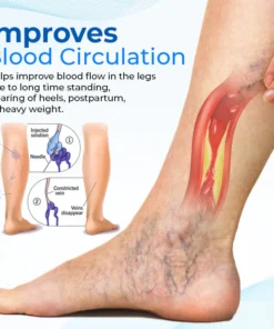 Biancat™ Legenda Varicose Vein Treatment Spray