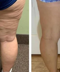 Biancat™ VitaLift Mugwort Fat-Burning Firming Cream