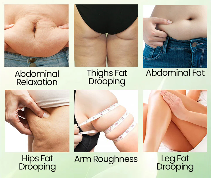 Biancat™ VitaLift Mugwort Fat-Burning Firming Cream