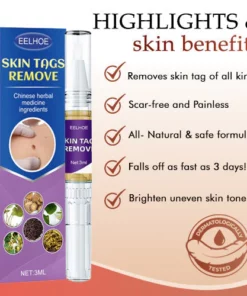 Alternative view of CCTM Tags & Moles Remover