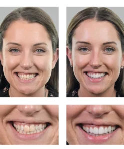 COLL-Boost™ Conopeptide Anti-Aging Essence (Botox)