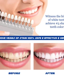 COLL-Boost™ Conopeptide Anti-Aging Essence (Botox)