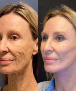 COLL-Boost™ Conopeptide Anti-Aging Essence