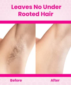 Ceoerty™ BeeSmooth Hair Removal Mousse