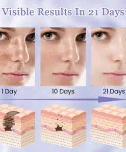 Ceoerty™ Bright Future Blemish Cream