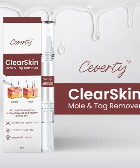 Ceoerty™ ClearSkin Mole & Tag Remover
