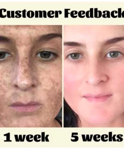 Alternative view of Ceoerty™ RadiantTouch Dark Spot Corrector Serum