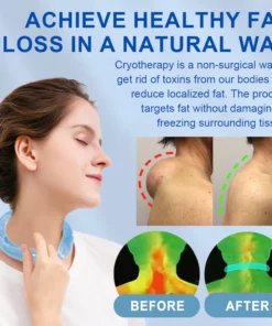 CoolTime™ Ion Lymphatic Relief Coolsculpting Neck Tube