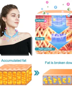 CoolTime™ Ion Lymphatic Relief Coolsculpting Neck Tube