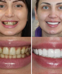 DENBRITE™ Oral Care Essence Foam