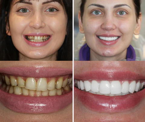 DENBRITE™ Oral Care Essence Foam