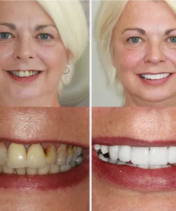 DENBRITE™ Oral Care Essence Foam