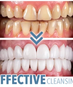 DENTAFix™ Electric Oral Water Flosser