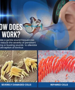 Dafeila™ AuriCalme Tinnitus Magnetic Therapy Device