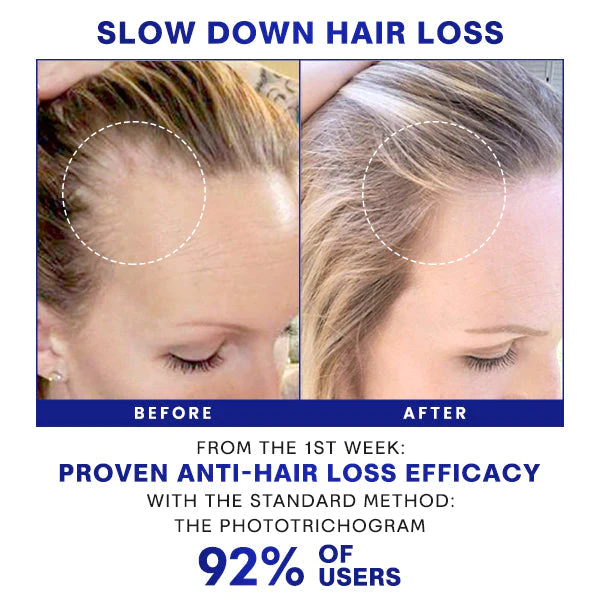 Densifique HairGrowth Formula Spray សេរ៉ូម