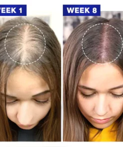 Densifique HairGrowth Formula Serum Spray