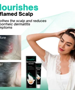 Dermaquelle™ Seborrheic Dermatitis Care Cream