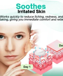 Dermaquelle™ Seborrheic Dermatitis Care Cream