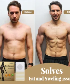 Dobshow™ Bee Venom Lymphatic Drainage Patch Detox Slimming Patch