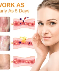 Dobshow™ Bee Venom Psoriasis Relief Cream